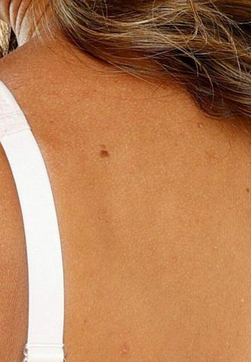 Бюстгальтер-минимайзер